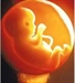 Nạn nạo thai dưới góc nhìn Phật Giáo